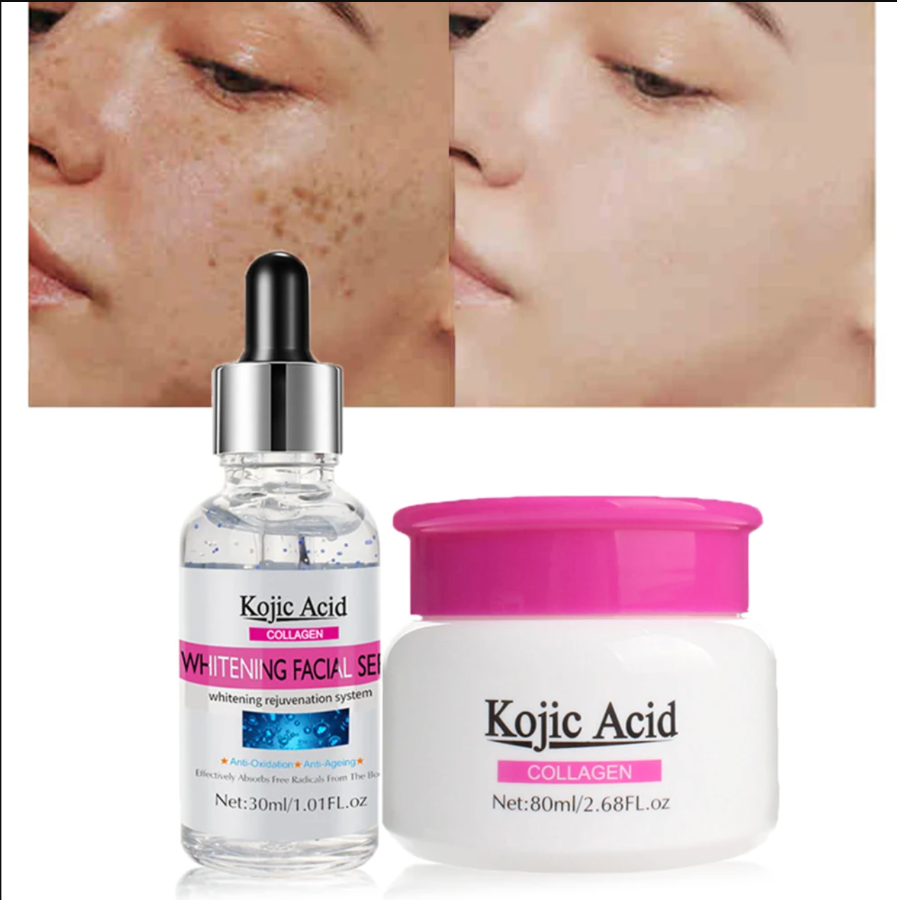SERUM FACIAL BLANQUEADOR KOJIC ACID