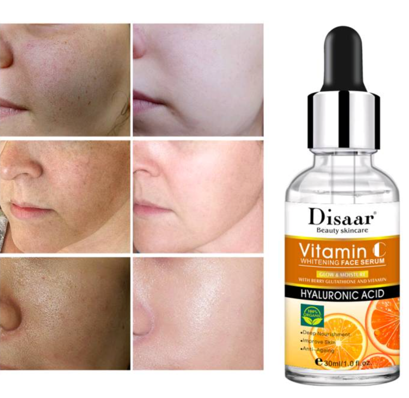 Suero Facial Blanqueador de Vitamina C DISAAR