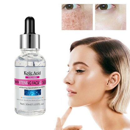 SERUM FACIAL BLANQUEADOR KOJIC ACID